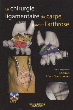 Bertrand.pt - La Chirurgie Ligamentaire Du Carpe Avant L'Arthrose