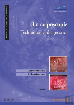 Bertrand.pt - La Colposcopie