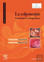 La Colposcopie