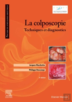 Bertrand.pt - La Colposcopie