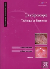 La Colposcopie ; Technique Et Diagnostics (3e Edition)