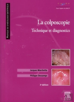 Bertrand.pt - La Colposcopie ; Technique Et Diagnostics (3e Edition)