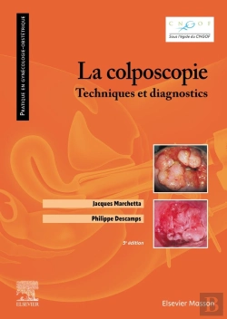 Bertrand.pt - La Colposcopie : Techniques Et Diagnostics (5e Édition)