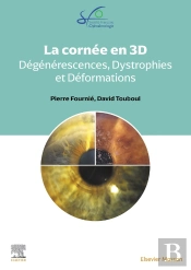 La Cornée En 3d : Dégénérescences, Dystrophies Et Déformations