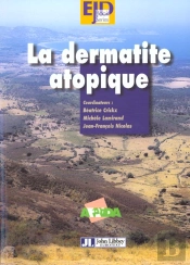 La Dermatite Atopique