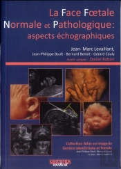 La Face Foetale Normale Et Pathologique: Aspects Échographiques