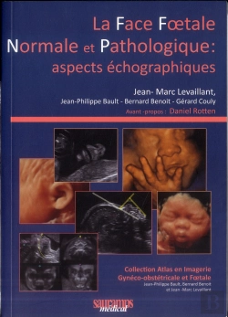 Bertrand.pt - La Face Foetale Normale Et Pathologique: Aspects Échographiques