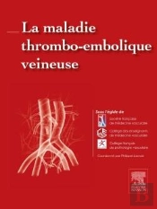 La Maladie Thromboembolique Veineuse