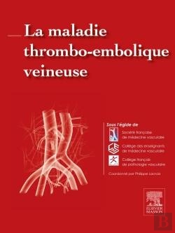 Bertrand.pt - La Maladie Thromboembolique Veineuse