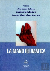 La Mano Reumatica