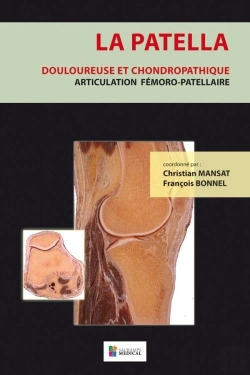 Bertrand.pt - La Patella ; Douloureuse Et Chondropathique, Articulation Fémoro-Patellaire