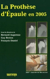 La Prothèse D'Épaule En 2005 ; Xiiième Journée De Menucourt