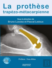 La Prothèse Trapézo-Métacarpienne