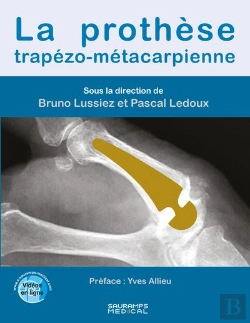 Bertrand.pt - La Prothèse Trapézo-Métacarpienne