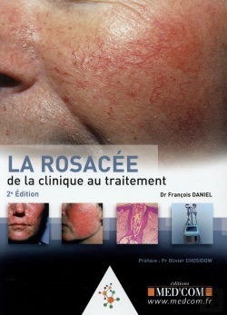 Bertrand.pt - La Rosacée ; De La Clinique Au Traitement