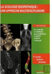 La Scoliose Idiopathique ; Une Approche Multidisciplinaire