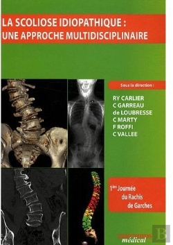 Bertrand.pt - La Scoliose Idiopathique ; Une Approche Multidisciplinaire