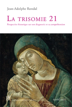 Bertrand.pt - La Trisomie 21 : Perspective Historique Sur Son Diagnostic Et Sa Compréhension