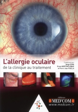 Bertrand.pt - L'Allergie Oculaire : De La Clinique Au Traitement
