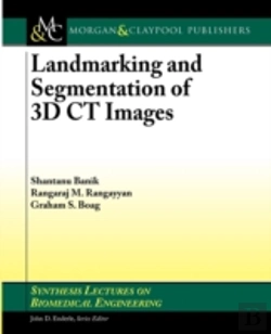 Bertrand.pt - Landmarking And Segmentation Of 3d Ct Images