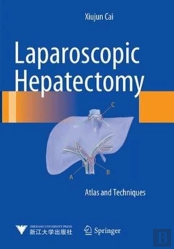 Bertrand.pt - Laparoscopic Hepatectomy