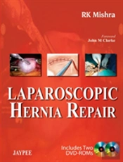 Laparoscopic Hernia Repair