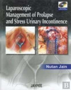 Bertrand.pt - Laparoscopic Management Of Prolapse And Stress Urinary Incontinence