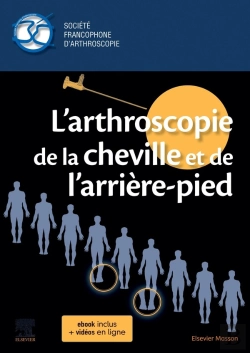 Bertrand.pt - L'Arthroscopie De La Cheville Et De L'Arrière-Pied
