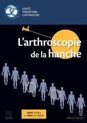 L'Arthroscopie De La Hanche