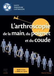 L'Arthroscopie De La Main, Du Poignet Et Du Coude
