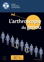 L'Arthroscopie Du Genou