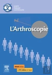 L'Arthroscopie