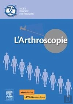 Bertrand.pt - L'Arthroscopie