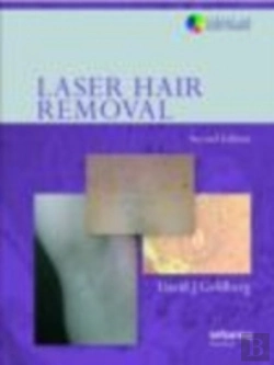 Bertrand.pt - Laser Hair Removal