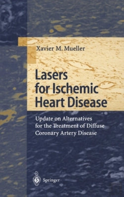 Bertrand.pt - Lasers For Ischemic Heart Disease