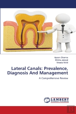 Bertrand.pt - Lateral Canals