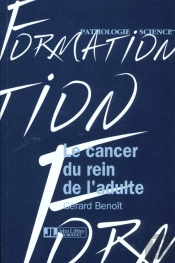 Le Cancer Du Rein De L'Adulte