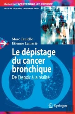 Bertrand.pt - Le Depistage Du Cancer Bronchique - De L'Espoir A La Realite