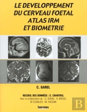 Le Développement Du Cerveau Foetal, Atlas Irm Et Biometrie