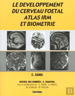 Bertrand.pt - Le Développement Du Cerveau Foetal, Atlas Irm Et Biometrie