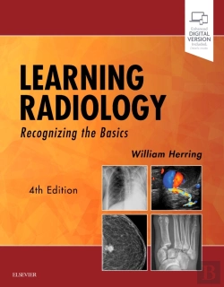 Bertrand.pt - Learning Radiology
