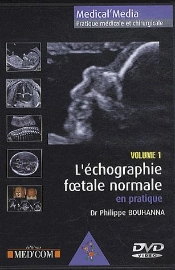 L'Echographie Foetale Normale Vol 1