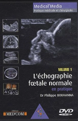 Bertrand.pt - L'Echographie Foetale Normale Vol 1