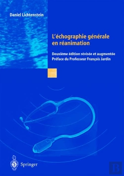 Bertrand.pt - L'Échographie Générale En Réanimation (2e Édition)