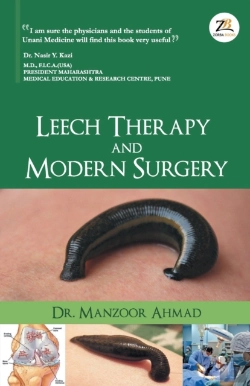 Bertrand.pt - Leech Therapy & Modern Surgery