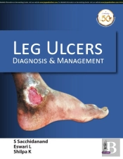 Leg Ulcers