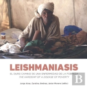 Leishmaniasis