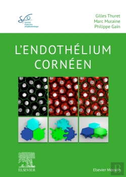 Bertrand.pt - L'Endothélium Cornéen