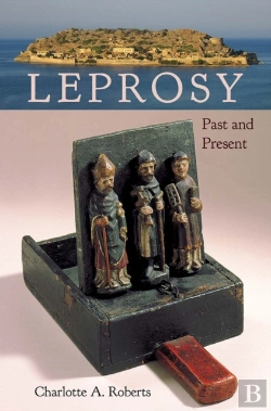 Bertrand.pt - Leprosy