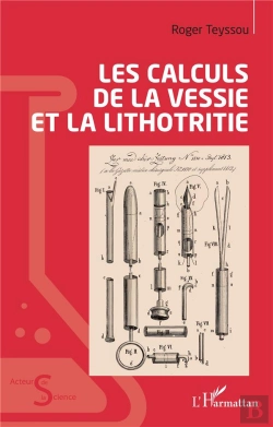 Bertrand.pt - Les Calculs De La Vessie Et La Lithotritie
